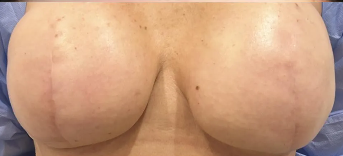 asd asd